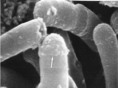 Сканирующая электронная микроскопия обособляющихся раскалывающимся способом клеток R. ruber ИЭГМ 333, х 50 000, выращенных на мясопептонном агаре