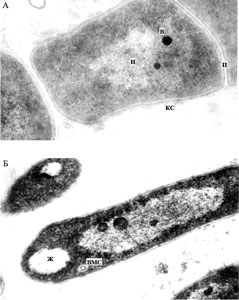 Ультратонкие срезы клеток R. ruber, выращенных на мясопептонном агаре